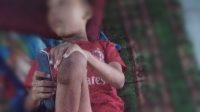 Alami Lumpuh Sejak Kecil, Dua Anak di Desa Bogangin Butuh Bantuan Kursi Roda